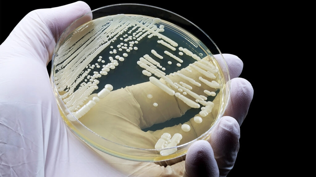 Candida auris